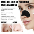 10 Pcs Blackhead - Nose Patch Nose Pore Cleansing Strips | Nova Goods