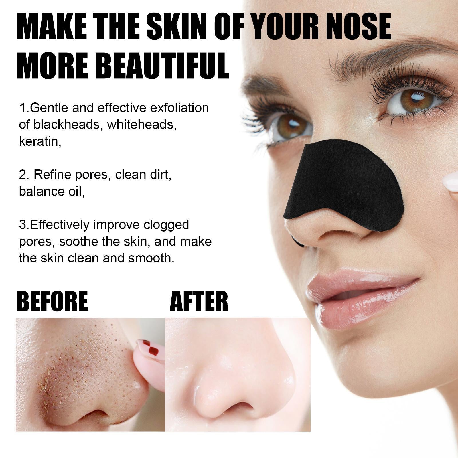 10 Pcs Blackhead - Nose Patch Nose Pore Cleansing Strips | Nova Goods