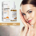 Eelhoe Turmeric Dark - Spot Correction Face Care Spot Moi | Nova Goods